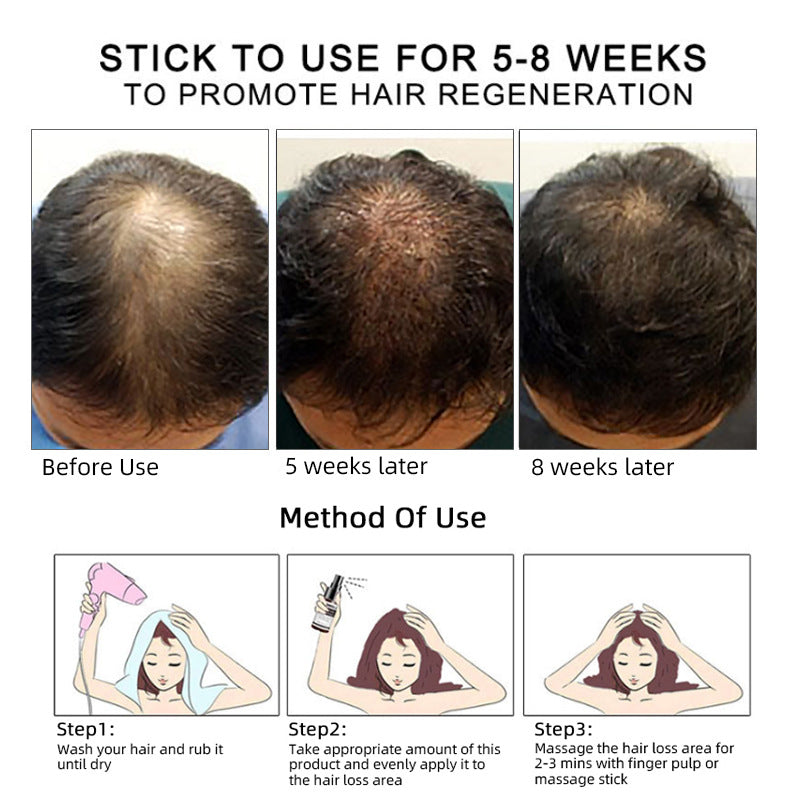 Hair Essence and Anti-Hair Loss Serum for Care